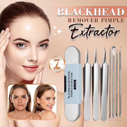 💓HOT SALE 56% OFF💥Medical grade blackhead cell clip tool set